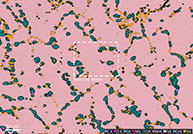 Examining state-of-the-art in energy dispersive x-ray spectrometers