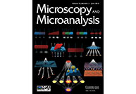 "Reflector Selection for the Indexing of Electron Backscatter Diffraction Patterns" from the June 2019 issue of Microscopy and Microanalysis